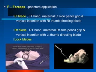 F – Forceps phantom application
Lt blade , LT hand, maternal Lt side pencil grip &
vertical insertion with Rt thumb directing blade
Rt blade , RT hand, maternal Rt side pencil grip &
vertical insertion with Lt thumb directing blade
Lock blades
 