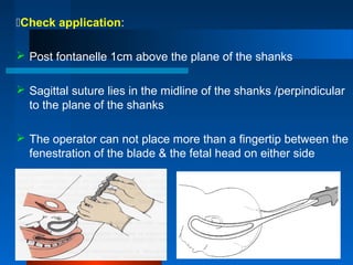 Check application:
 Post fontanelle 1cm above the plane of the shanks
 Sagittal suture lies in the midline of the shanks /perpindicular
to the plane of the shanks
 The operator can not place more than a fingertip between the
fenestration of the blade & the fetal head on either side
 