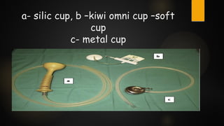 a- silic cup, b –kiwi omni cup –soft
cup
c- metal cup
 