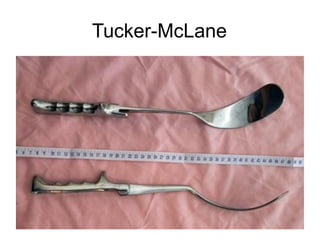 Tucker-McLane
 