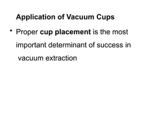 Application of Vacuum Cups
• Proper cup placement is the most
important determinant of success in
vacuum extraction
 