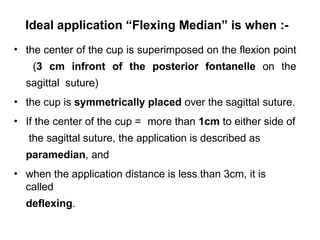 Ideal application “Flexing Median” is when :-
•
•
•
•
the center of the cup is superimposed on the flexion point
(3 cm infront of the posterior fontanelle on the
sagittal suture)
the cup is symmetrically placed over the sagittal suture.
If the center of the cup = more than 1cm to either side of
the sagittal suture, the application is described as
paramedian, and
when the application distance is less than 3cm, it is
called
deflexing.
 