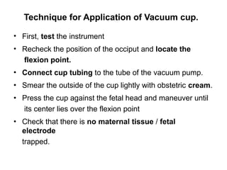 Technique for Application of Vacuum cup.
•
•
•
•
•
•
First, test the instrument
Recheck the position of the occiput and locate the
flexion point.
Connect cup tubing to the tube of the vacuum pump.
Smear the outside of the cup lightly with obstetric cream.
Press the cup against the fetal head and maneuver until
its center lies over the flexion point
Check that there is no maternal tissue / fetal
electrode
trapped.
 