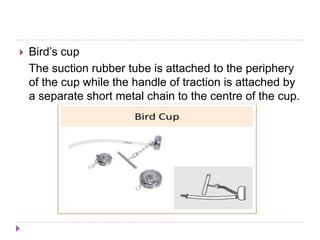  Bird’s cup
The suction rubber tube is attached to the periphery
of the cup while the handle of traction is attached by
a separate short metal chain to the centre of the cup.
 
