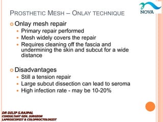 Diastasis recti repair with onlay mesh