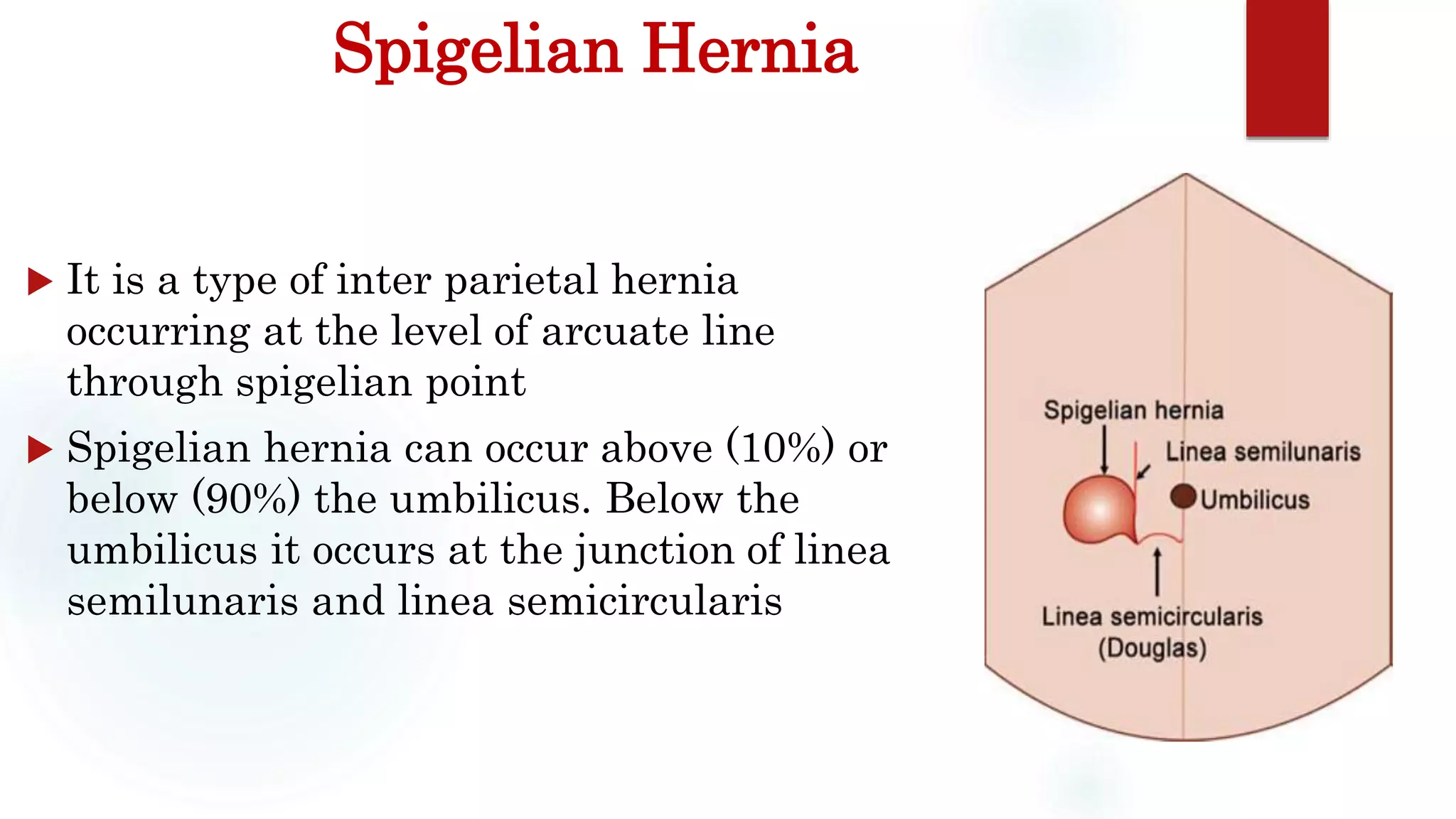VENTRAL HERNIA | PPTX