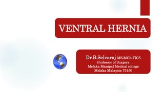 Dr.B.Selvaraj MS;MCh;FICS
Professor of Surgery
Melaka Manipal Medical college
Melaka Malaysia 75150
VENTRAL HERNIA
 