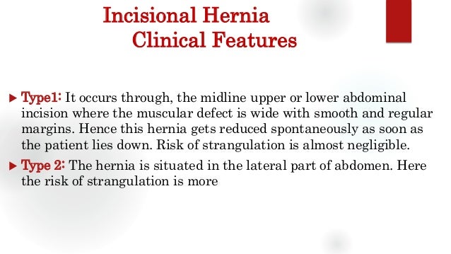 Ventral Hernia