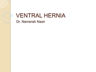 VENTRAL HERNIA
Dr. Namerah Nasir
 