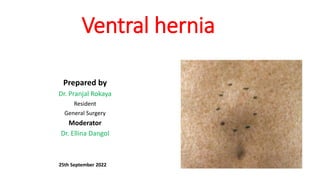 Ventral hernia
Prepared by
Dr. Pranjal Rokaya
Resident
General Surgery
Moderator
Dr. Ellina Dangol
25th September 2022
 