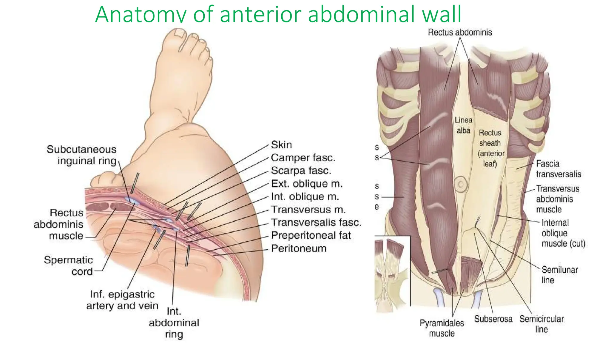 VENTRAL HERNIA - Abdominal Wall Reconstruction AWR - Surgery -Repair ...