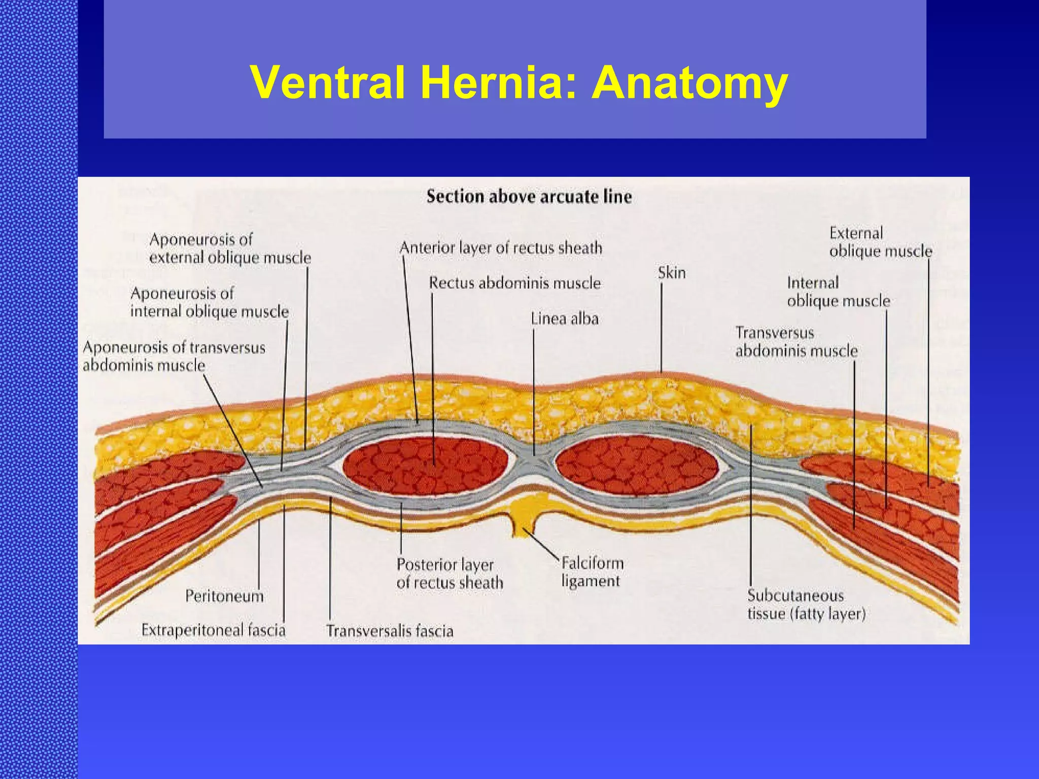 Ventral Hernia: Anatomy 