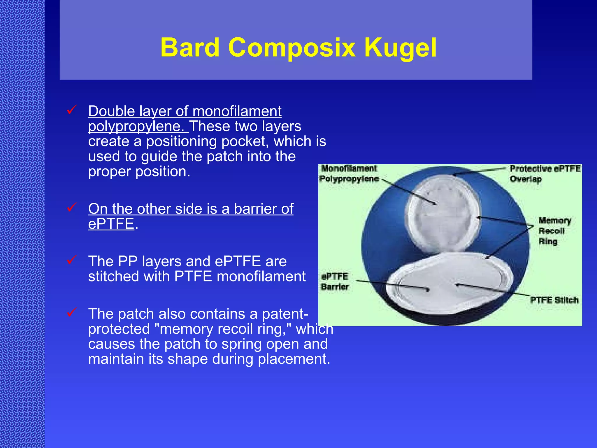 Bard Composix Kugel Double layer of monofilament polypropylene.  These two layers create a positioning pocket, which is used to guide the patch into the proper position.  On the other side is a barrier of ePTFE .  The PP layers and ePTFE are stitched with PTFE monofilament The patch also contains a patent-protected "memory recoil ring," which causes the patch to spring open and maintain its shape during placement. 
