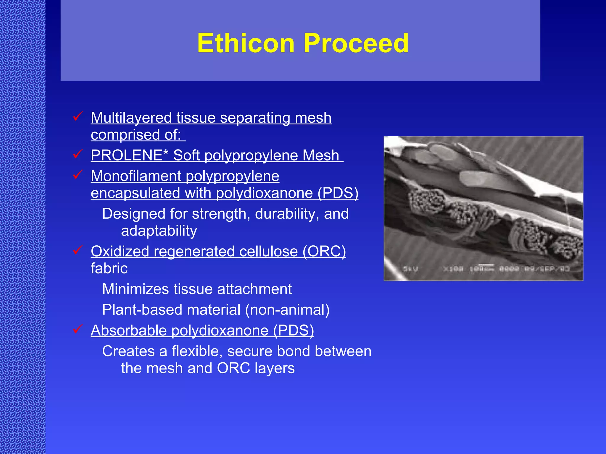 Ethicon Proceed Multilayered tissue separating mesh comprised of:  PROLENE* Soft polypropylene Mesh  Monofilament polypropylene encapsulated with polydioxanone (PDS) Designed for strength, durability, and adaptability  Oxidized regenerated cellulose (ORC)  fabric Minimizes tissue attachment Plant-based material (non-animal)  Absorbable polydioxanone (PDS) Creates a flexible, secure bond between the mesh and ORC layers  