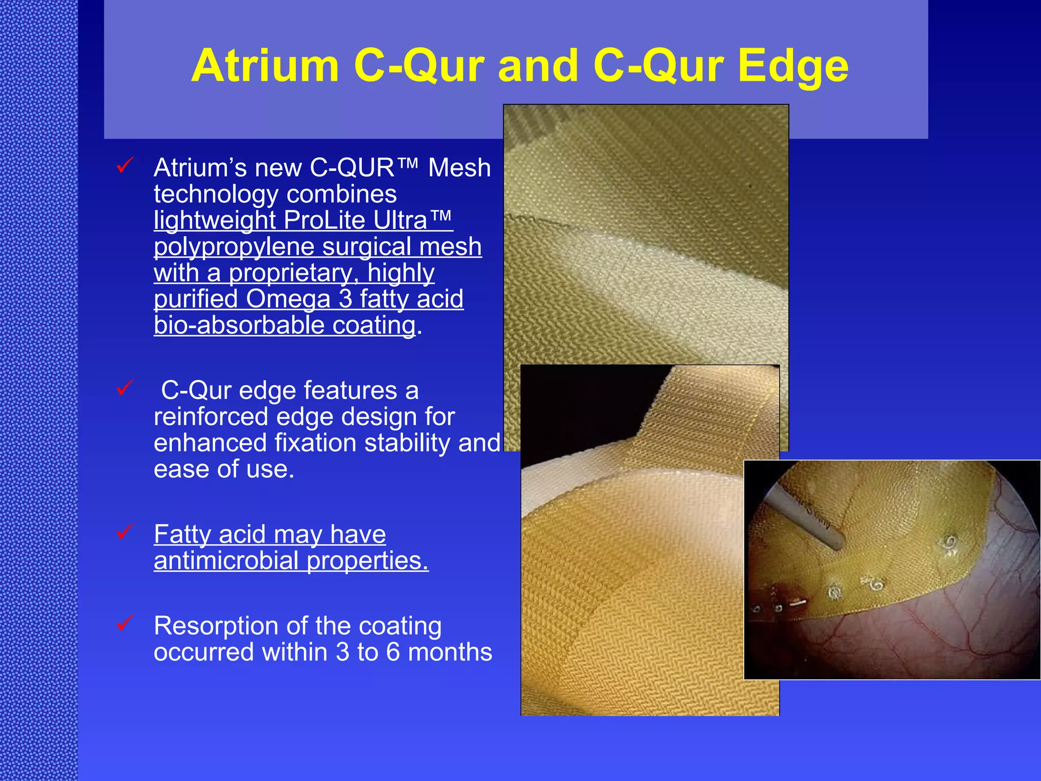 Atrium C-Qur and C-Qur Edge Atrium’s new C-QUR™ Mesh technology combines  lightweight ProLite Ultra™ polypropylene surgical mesh with a proprietary, highly purified Omega 3 fatty acid bio-absorbable coating . C-Qur edge features a reinforced edge design for enhanced fixation stability and ease of use. Fatty acid may have antimicrobial properties. Resorption of the coating occurred within 3 to 6 months 