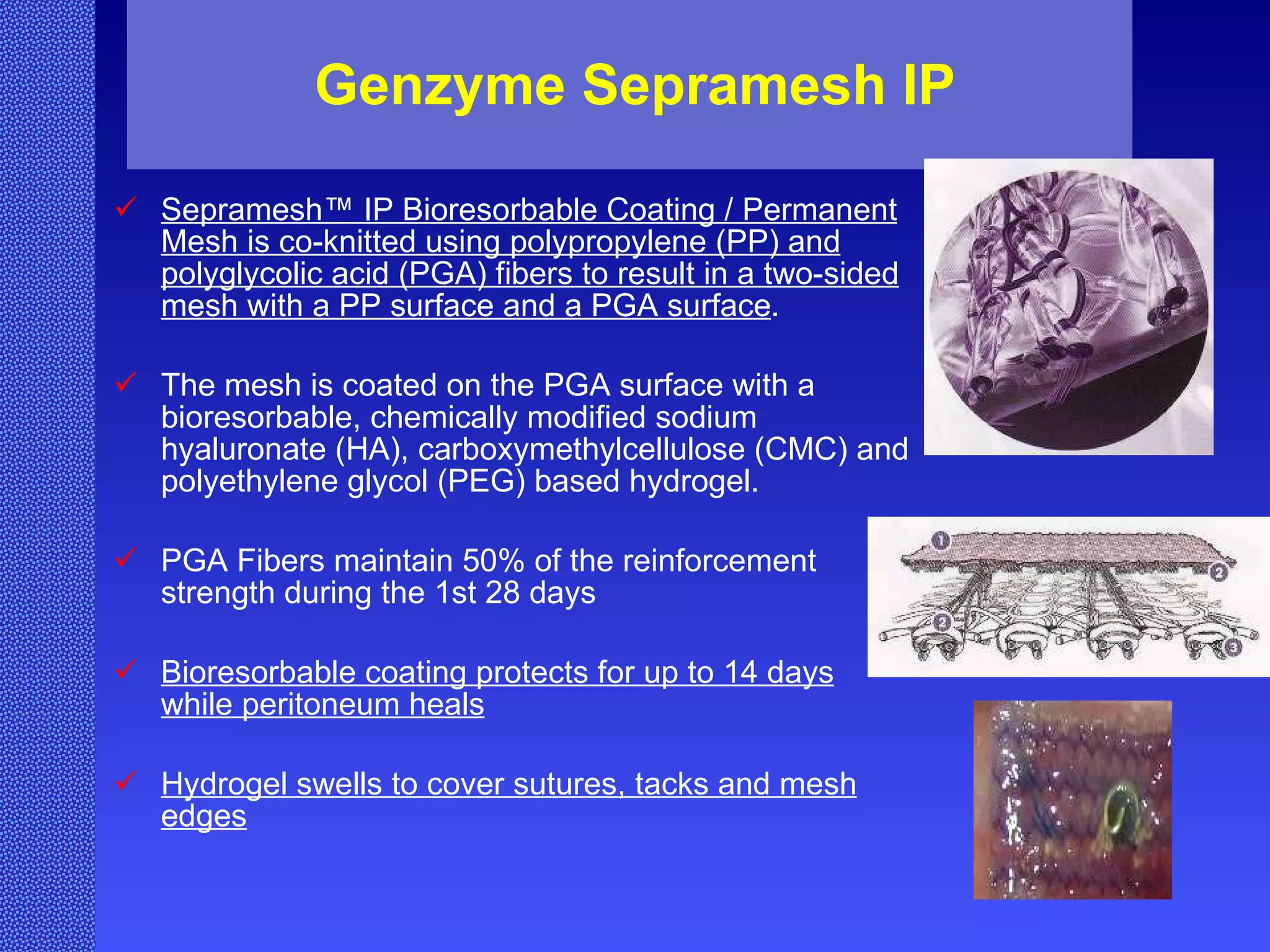 Genzyme Sepramesh IP Sepramesh™ IP Bioresorbable Coating / Permanent Mesh is co-knitted using polypropylene (PP) and polyglycolic acid (PGA) fibers to result in a two-sided mesh with a PP surface and a PGA surface .  The mesh is coated on the PGA surface with a bioresorbable, chemically modified sodium hyaluronate (HA), carboxymethylcellulose (CMC) and polyethylene glycol (PEG) based hydrogel. PGA Fibers maintain 50% of the reinforcement strength during the 1st 28 days Bioresorbable coating protects for up to 14 days while peritoneum heals Hydrogel swells to cover sutures, tacks and mesh edges 