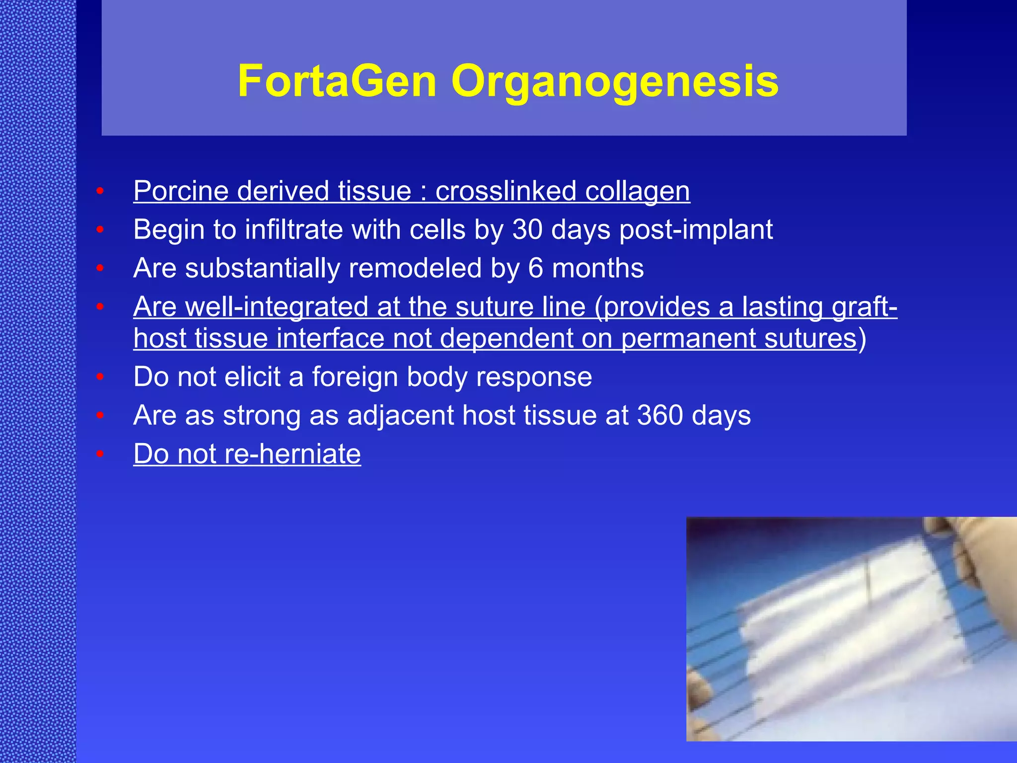 FortaGen Organogenesis Porcine derived tissue : crosslinked collagen Begin to infiltrate with cells by 30 days post-implant Are substantially remodeled by 6 months Are well-integrated at the suture line (provides a lasting graft-host tissue interface not dependent on permanent sutures ) Do not elicit a foreign body response Are as strong as adjacent host tissue at 360 days Do not re-herniate 