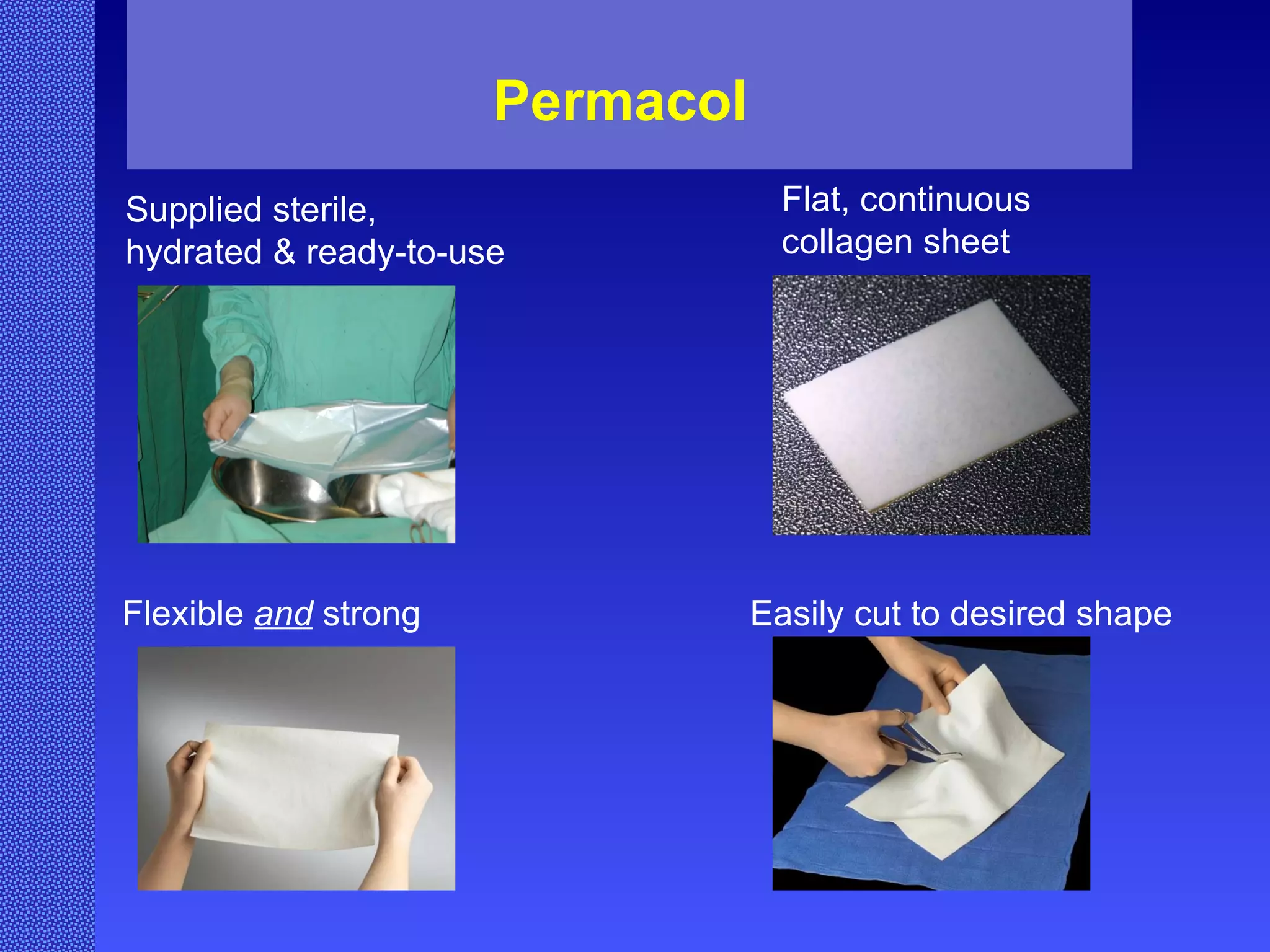 Permacol   Supplied sterile, hydrated & ready-to-use Flexible  and  strong Flat, continuous collagen sheet Easily cut to desired shape   