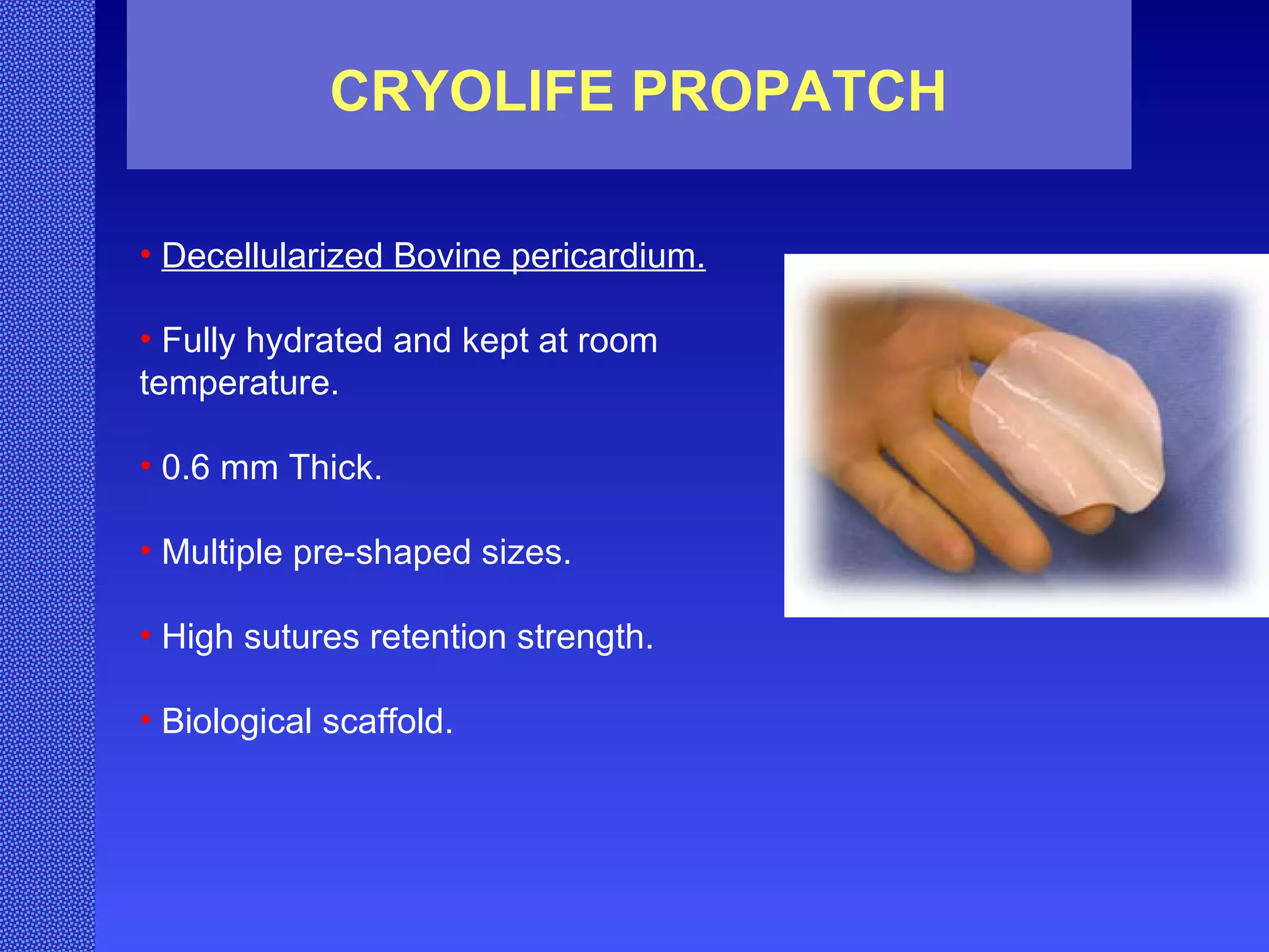 CRYOLIFE PROPATCH Decellularized Bovine pericardium. Fully hydrated and kept at room temperature. 0.6 mm Thick. Multiple pre-shaped sizes. High sutures retention strength. Biological scaffold. 