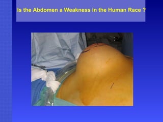 Is the Abdomen a Weakness in the Human Race ? 