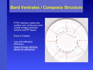 Bard Ventralex / Composix Structure PTFE stitches makes the surface non continuous and create bridges between viscera and PP layers Easy to implant. Low anti-adhesion efficiency. Holes through stitching allows for adhesions . 