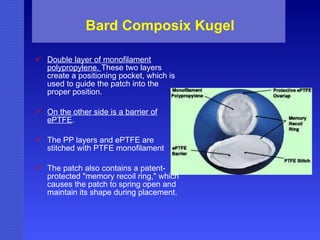 Bard Composix Kugel Double layer of monofilament polypropylene.  These two layers create a positioning pocket, which is used to guide the patch into the proper position.  On the other side is a barrier of ePTFE .  The PP layers and ePTFE are stitched with PTFE monofilament The patch also contains a patent-protected "memory recoil ring," which causes the patch to spring open and maintain its shape during placement. 