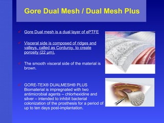 Gore Dual Mesh / Dual Mesh Plus Gore Dual mesh is a dual layer of ePTFE Visceral side is composed of ridges and valleys, called as Corduroy, to create porosity (22 µm). The smooth visceral side of the material is brown. GORE-TEX® DUALMESH® PLUS Biomaterial is impregnated with two antimicrobial agents – chlorhexidine and silver – intended to inhibit bacterial colonization of the prosthesis for a period of up to ten days post-implantation. 
