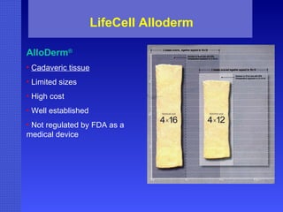 LifeCell Alloderm AlloDerm ® Cadaveric tissue Limited sizes High cost Well established Not regulated by FDA as a medical device 