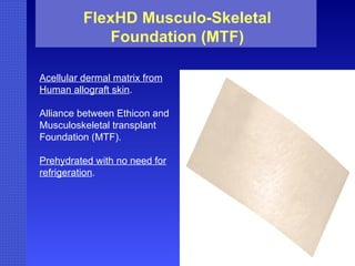FlexHD Musculo-Skeletal Foundation (MTF) Acellular dermal matrix from Human allograft skin . Alliance between Ethicon and  Musculoskeletal transplant Foundation (MTF). Prehydrated with no need for refrigeration .  