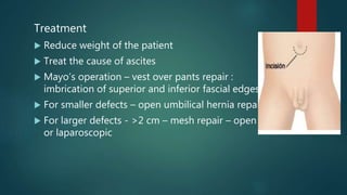 Treatment
 Reduce weight of the patient
 Treat the cause of ascites
 Mayo’s operation – vest over pants repair :
imbrication of superior and inferior fascial edges
 For smaller defects – open umbilical hernia repair
 For larger defects - >2 cm – mesh repair – open
or laparoscopic
 