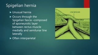 Spigelian hernia
 Unusual hernia
 Occurs through the
Spigelian fascia –composed
of aponeurotic layer
between rectus muscle
medially and semilunar line
laterally
 Often interparietal
 