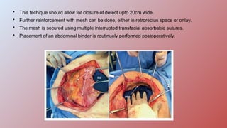 ventral hernia repair-DEPARTMENT OF GENERAL SURGERY | PPTX