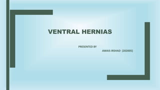 VENTRAL HERNIAS
PRESENTED BY
AWAIS IRSHAD (202005)
 