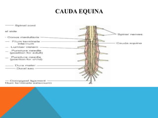 CAUDA EQUINA
 