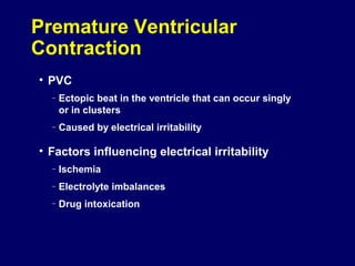Premature Ventricular
Contraction
• PVC
–

Ectopic beat in the ventricle that can occur singly
or in clusters

–

Caused by electrical irritability

• Factors influencing electrical irritability
–

Ischemia

–

Electrolyte imbalances

–

Drug intoxication

 