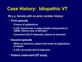 Case History: Idiopathic VT
39 y.o. female with no prior cardiac history
• First episode
–

9 hours of palpitations

–

In ER, found to be in wide-complex tachycardia of
LBBB, inferior axis, at 205 bpm

–

Converted with IV lidocaine; placed on tenormin

• Second episode
–

While on tenormin, patient had onset of palpitations
at airport

–

In ER, converted with IV lidocaine

• Patient underwent EP study

 