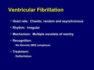 Ventricular Fibrillation
• Heart rate: Chaotic, random and asynchronous
• Rhythm: Irregular
• Mechanism: Multiple wavelets of reentry
• Recognition:
–

No discrete QRS complexes

• Treatment:
–

Defibrillation

 