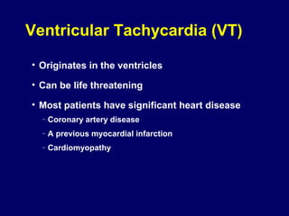 Ventricular Tachycardia (VT)
• Originates in the ventricles
• Can be life threatening
• Most patients have significant heart disease
–

Coronary artery disease

–

A previous myocardial infarction

–

Cardiomyopathy

 