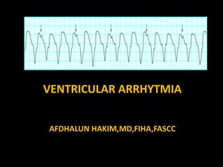 AFDHALUN HAKIM,MD,FIHA,FASCC
VENTRICULAR ARRHYTMIA
 