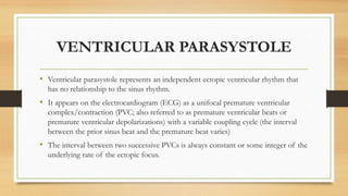 Ventricular arrythmia | PPTX