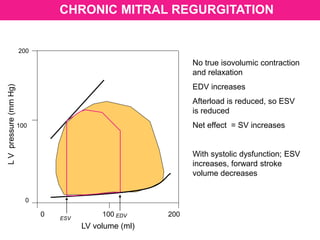 LV volume (ml)
LVpressure(mmHg)
200
100
0
0 100 200
ESV
EDV
CHRONIC MITRAL REGURGITATION
No true isovolumic contraction
and relaxation
EDV increases
Afterload is reduced, so ESV
is reduced
Net effect = SV increases
With systolic dysfunction; ESV
increases, forward stroke
volume decreases
 