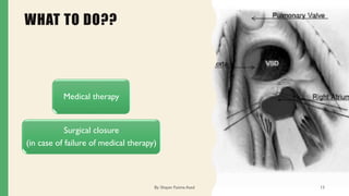 WHAT TO DO??
Medical therapy
Surgical closure
(in case of failure of medical therapy)
By: Shayan Fatima Azad 13
 