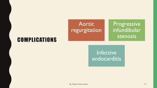 COMPLICATIONS
Aortic
regurgitation
Progressive
infundibular
stenosis
Infective
endocarditis
By: Shayan Fatima Azad 14
 