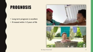 PROGNOSIS
• Long term prognosis is excellent
• If treated within 1-2 years of life
By: Shayan Fatima Azad 15
 