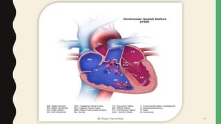 By: Shayan Fatima Azad 4
 