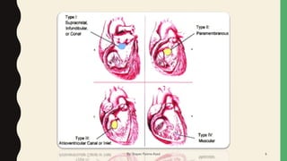 By: Shayan Fatima Azad 6
 