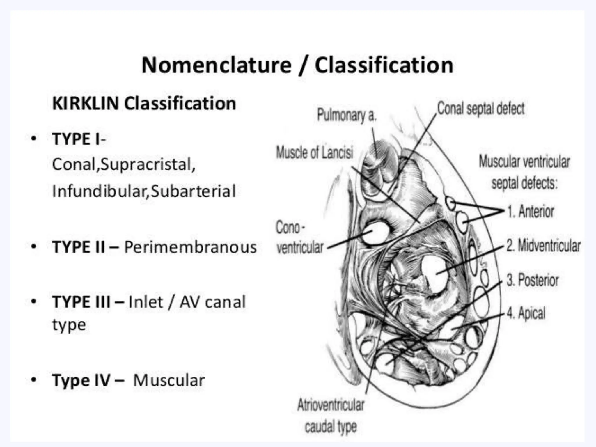 Vsd Types Radiology Imaging of Ventricular Septal Defects.ppt