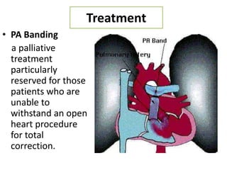 Treatment
• PA Banding
  a palliative
  treatment
  particularly
  reserved for those
  patients who are
  unable to
  withstand an open
  heart procedure
  for total
  correction.
 