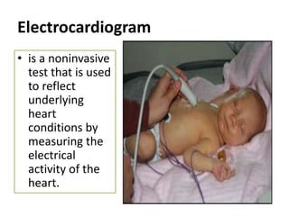 Electrocardiogram
• is a noninvasive
  test that is used
  to reflect
  underlying
  heart
  conditions by
  measuring the
  electrical
  activity of the
  heart.
 