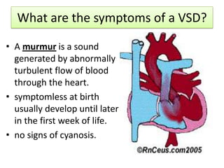 What are the symptoms of a VSD?

• A murmur is a sound
  generated by abnormally
  turbulent flow of blood
  through the heart.
• symptomless at birth
  usually develop until later
  in the first week of life.
• no signs of cyanosis.
 